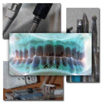 Fotografía en negativo de una dentadura.
